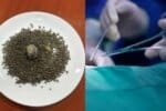 gall bladder operation 2026 08 c6ae4f664f61f2413ba5cb57070c8b97 1200x675